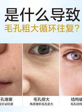 毛孔收细紧致精华液ANGLEE控油