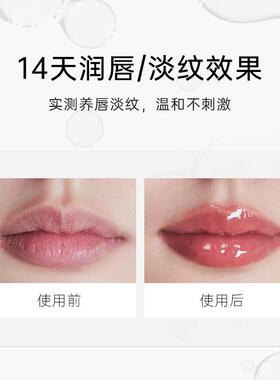 foreverkey唇部精华修护淡化唇纹