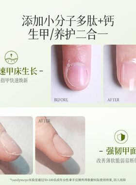 CandyMoyo生长水指甲护理营养油