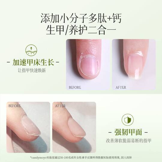 CandyMoyo Growth Water Nail Care Nutrient Oil