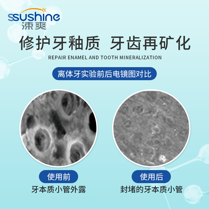 涑爽无氟正畸减少牙菌斑维护牙膏 涑爽牙膏