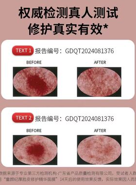 童颜纪青少年补水修护面膜焕白提亮舒缓去黄保湿御氧化面膜学生党