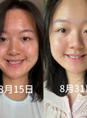 樊振东分享男女通用清爽细腻