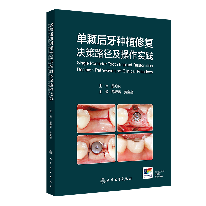 任选 单颗后牙种植修复决策路径及操作实践/美学区单颗牙种植修复ABCD原则/单颗牙种植技术前牙及后牙拔牙窝微创种植方案陈泽涛等
