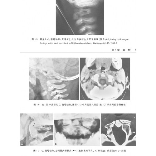 正版现货 易误诊解剖变异影像学图谱 第9版九 影像解剖学 正常变异误判书籍影像解剖学图谱图解与诊断影像解析临床医学书籍 - 图3