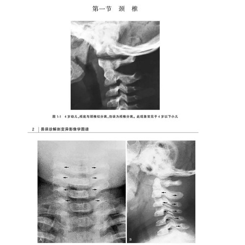 正版现货 易误诊解剖变异影像学图谱 第9版九 影像解剖学 正常变异误判书籍影像解剖学图谱图解与诊断影像解析临床医学书籍 - 图2