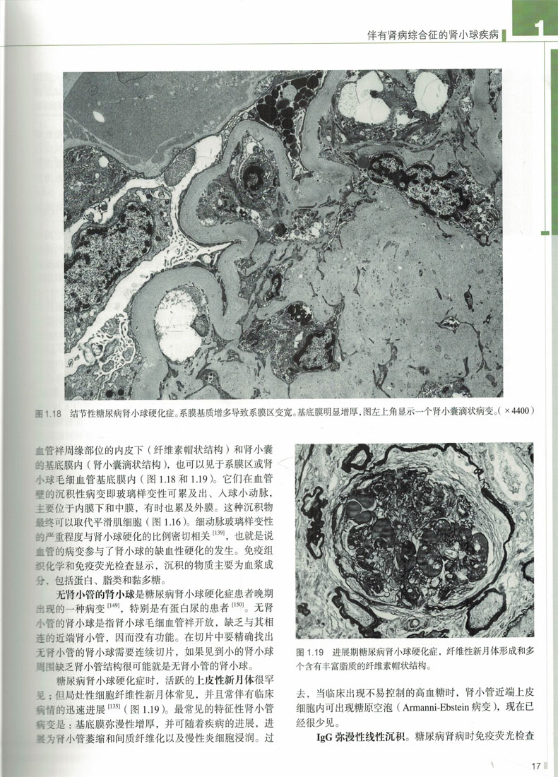 正版现货罗塞-阿克曼外科病理学第10版泌尿道与男性生殖系统分册北京大学医学出版社-图3