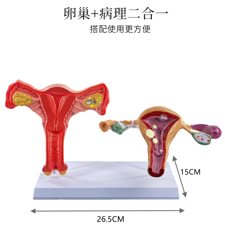 女性子宫模型卵巢模型女性阴道A女性内生殖器解剖模型妇科培训 - 图1