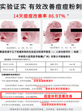 荘典龙脑祛痘水祛痘去闭口粉刺
