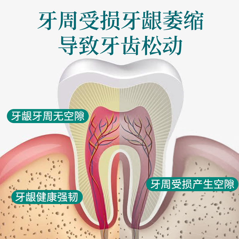 草方野菊花清火去口臭草本牙膏清新口气防蛀固齿去牙渍降火不含氟