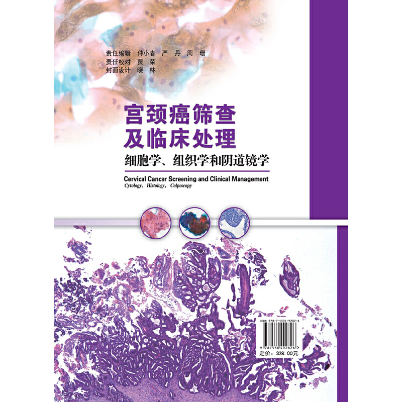 【书】宫颈癌筛查及临床处理细胞学、组织学和阴道镜学杨敏周先荣主编北京科学技术出版社精装彩图临床实践临床治疗-图1