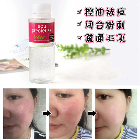 pore closing toner