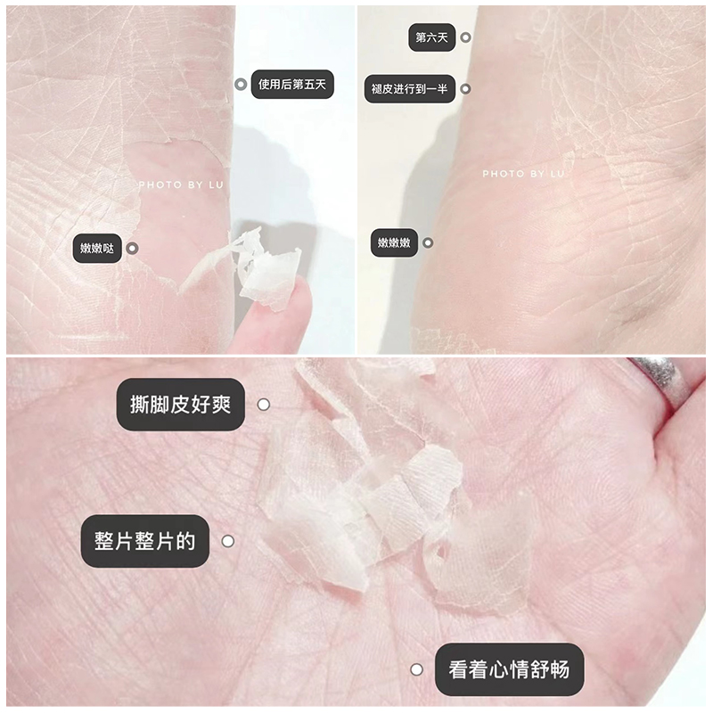 日本babyfoot足膜脚膜去死皮老茧角质保湿蜕皮柔嫩一次性足膜套 - 图2