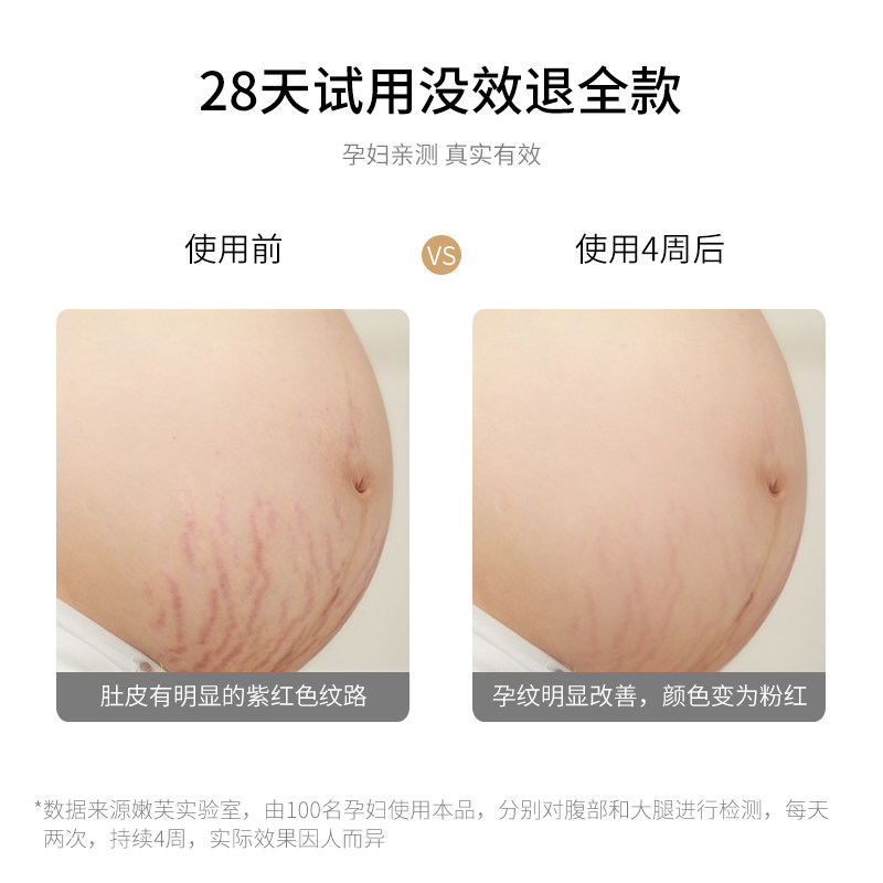 德国嫩芙叶酸孕妇专用去除修复霜 嫩芙妊娠纹护理