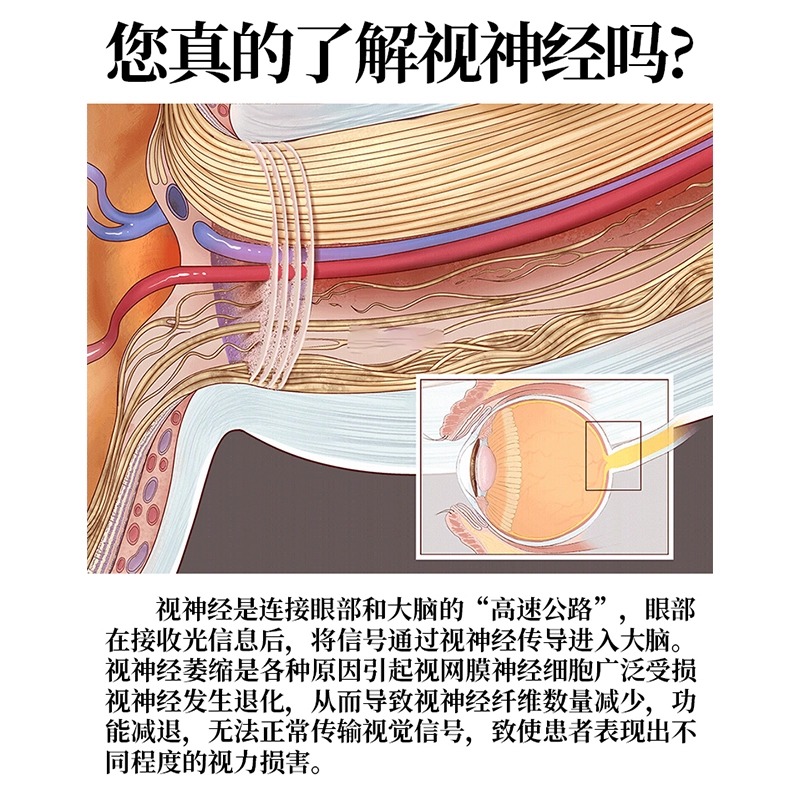 视神经修复专用神器眼睛萎缩模糊看不清重影干涩疲劳滴眼液 - 图1