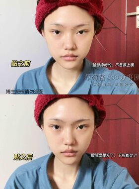 面部提拉小脸贴隐形胶带