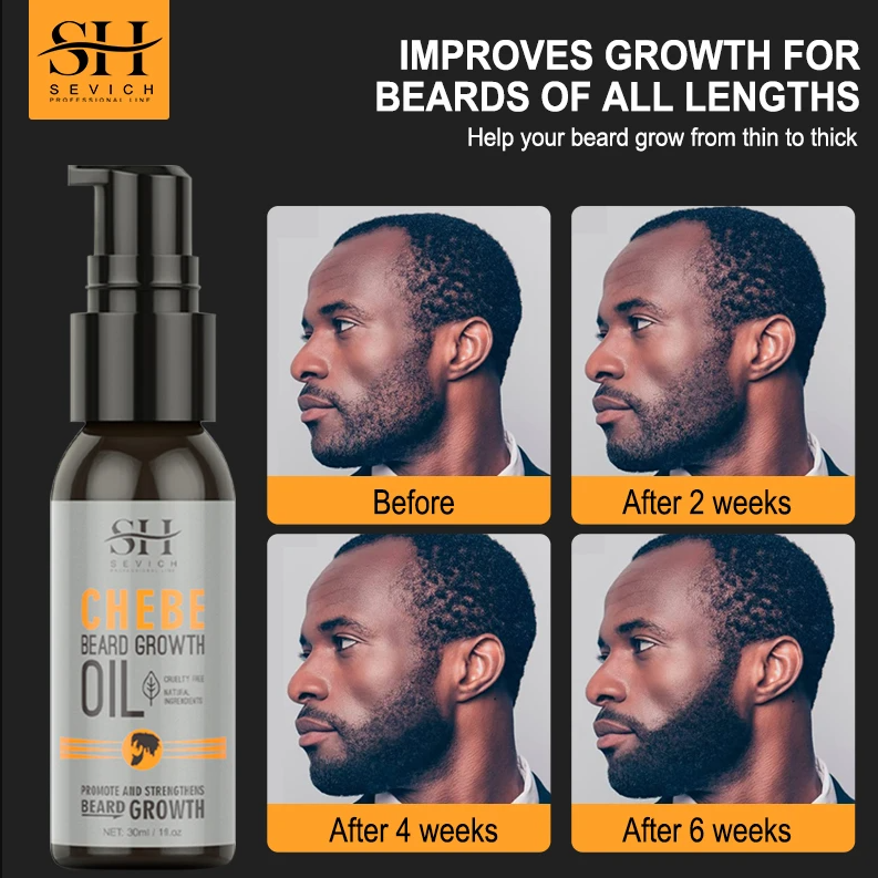 2023 Natural Chebe Beard Growth Oil Fast Effective Treatment - 图0