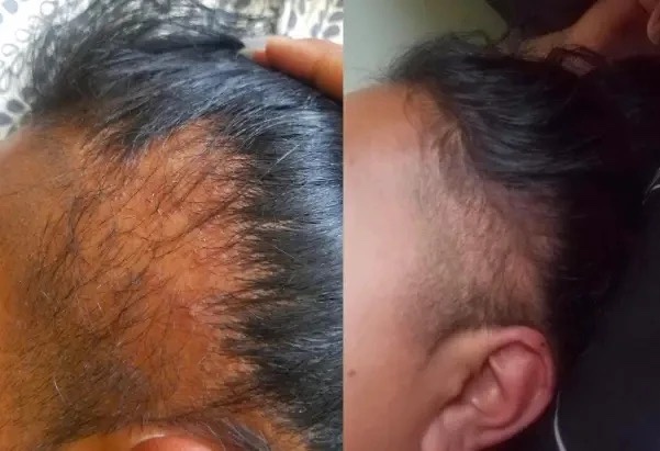 Black Seed Castor Oil Hair Growth Serum Thick Fast Growth-图3