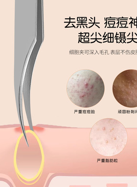 多功能圆弧海豚夹细胞夹化妆师专用黑头粉刺精细镊子新手美妆工具