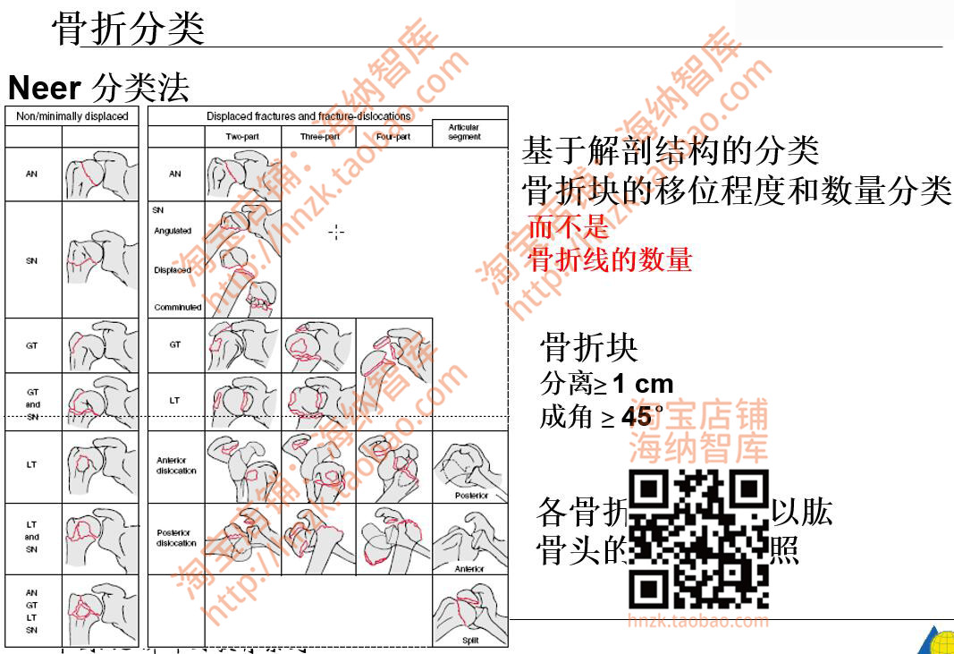 骨科医学PPT课件关节脊柱临床分型影像足踝肱骨MRI骨盆骨折创伤 - 图0