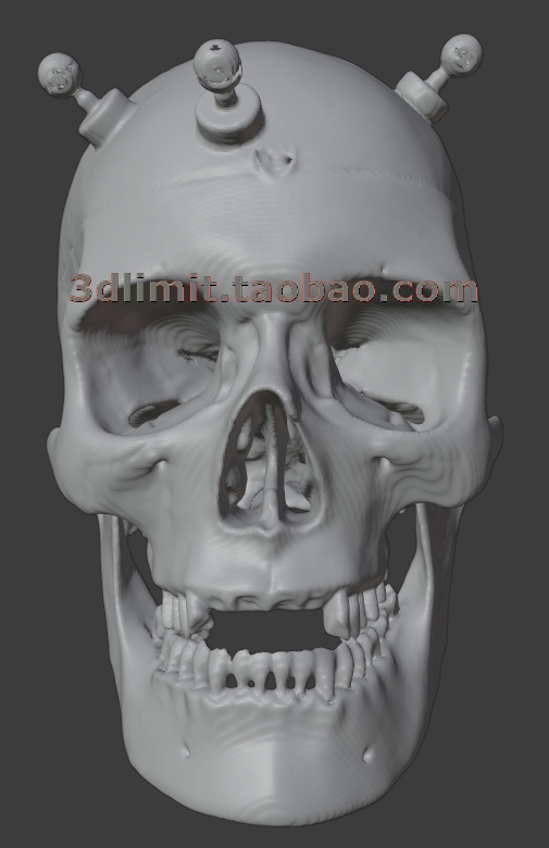 3D打印扫描DICOM dcm CT医学数据转换3D模型stl obj gltf dae fbx - 图3