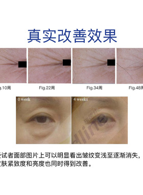 玻色因多胜肽眼霜七叶树抗皱淡化细纹黑眼圈舒缓15g芋螺肽