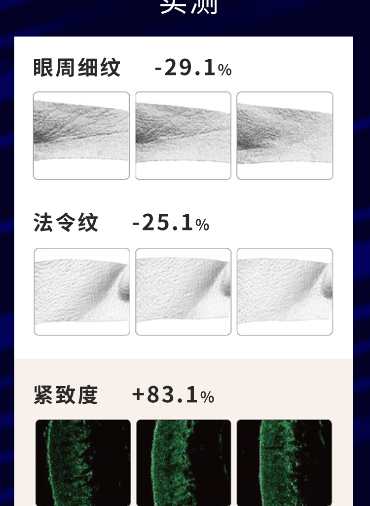 兰觅手持7d聚拉媞美容仪器淡皱家用脸部提拉紧致面部嫩肤HIFU超声 - 图3