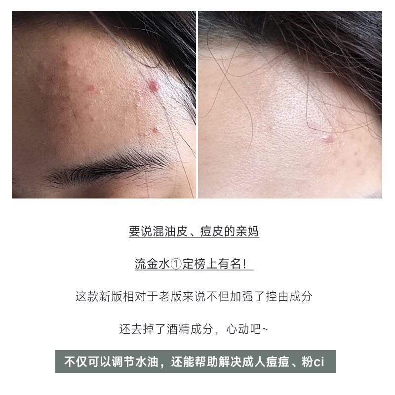 茵芙莎流金水鎏金水控油日本爽肤水 喃喃家美妆化妆水/爽肤水