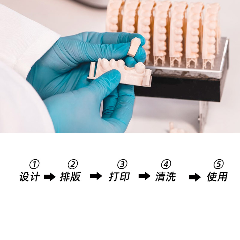 齿科3d打印机牙膜类牙冠铸造口腔种植牙模导板树脂材料临时冠耗材-图2