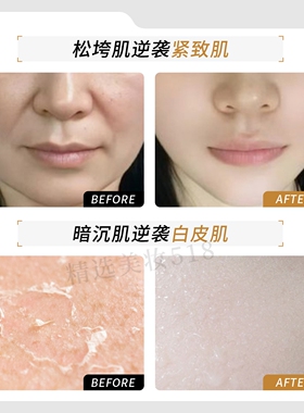 佩恩逆龄抗皱系列面部护理套装