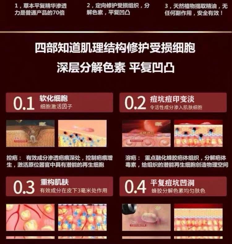 祛痘印痘坑痘疤凹洞填充去痘坑修复细胞再生微针去复平除逗男士女-图1