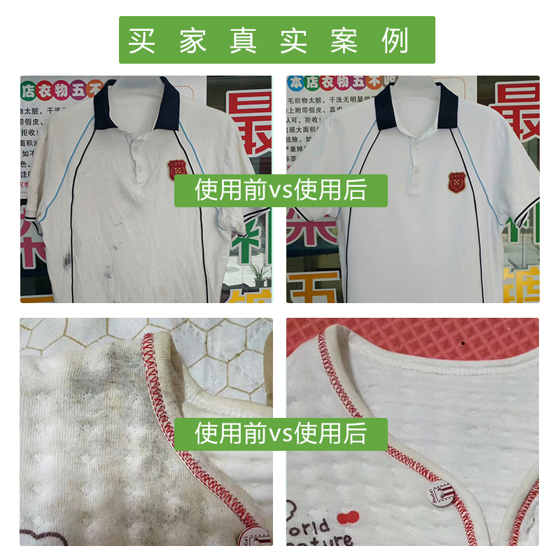 去霉点霉斑清洁剂衣服发霉去除黑点霉菌除霉剂黄斑衣物乌鸡清除剂 - 图1