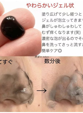 日本Juso kuro黑碳酸泡沫去黑头鼻膜 炭吸附清洁细毛孔草莓鼻50g