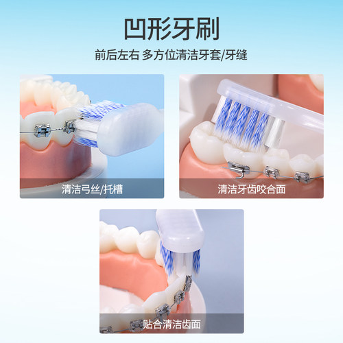 医洁正畸牙刷牙套牙箍专用牙刷牙缝刷凹型软毛牙套正畸牙刷 - 图3