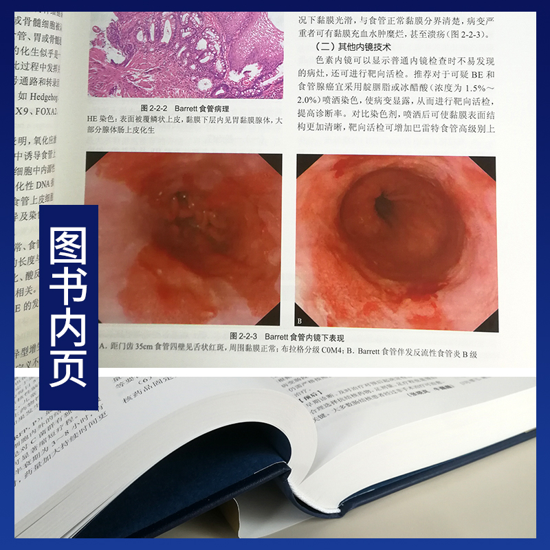 【询单优惠】正版消化病学实用消化道内科学书籍内镜系统疾病高级教程胃肠镜诊断图谱京都胃炎分类病理参考书陈旻湖杨云生唐承 - 图2