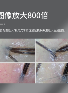 皮肤分析仪头皮检测仪热卖新品