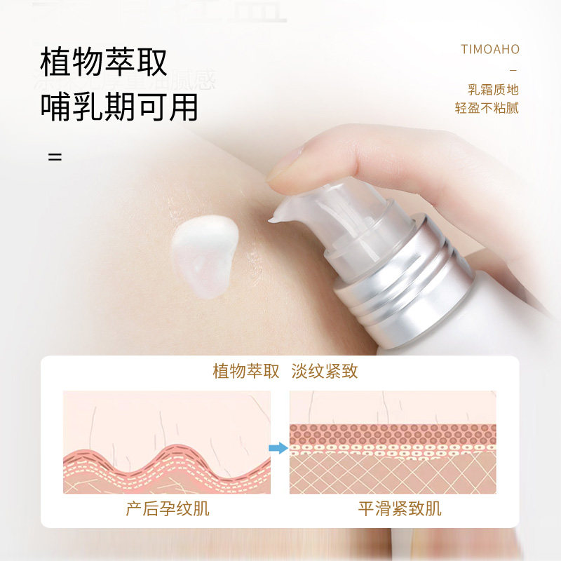 体美雅会去妊娠纹产后消除修复霜 体美雅会兰婷妊娠纹护理