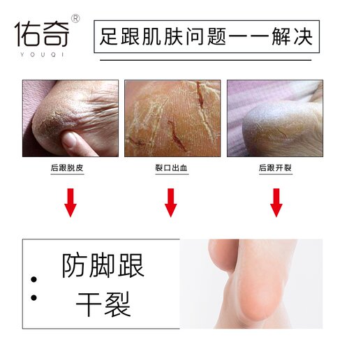 5双佑奇防裂袜脚裂袜子防脚后跟干裂开裂足裂袜冬季男女厚棉足跟 - 图0