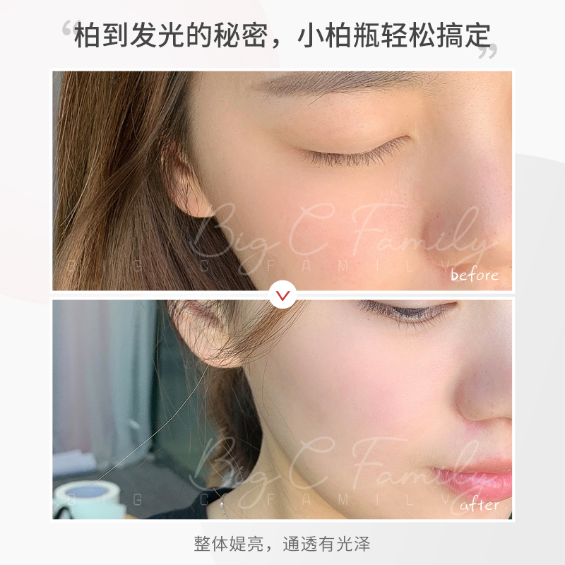 大C香港站olay小白瓶玉兰油女光感补水透白提亮修护精华液小绿瓶升级版30ml2
