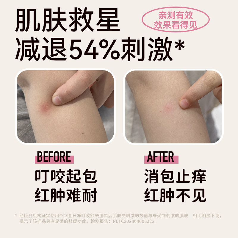 CCZ全日净止痒舒缓湿巾婴儿儿童宝宝户外蚊子蚊虫叮咬止痒修护,淘宝优惠券,粉丝福利购,淘宝优惠卷
