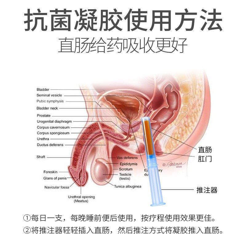 邦列安前列腺炎贴治疗抗菌凝胶 好药师大药房保健理疗