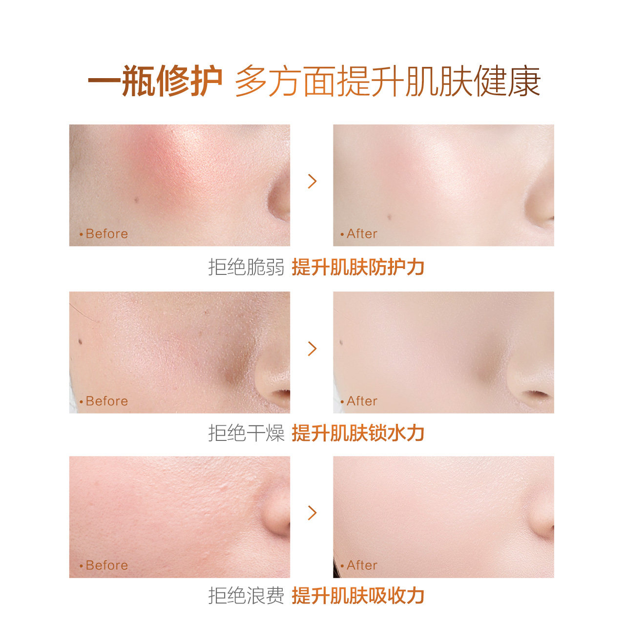  小迷糊液态精华