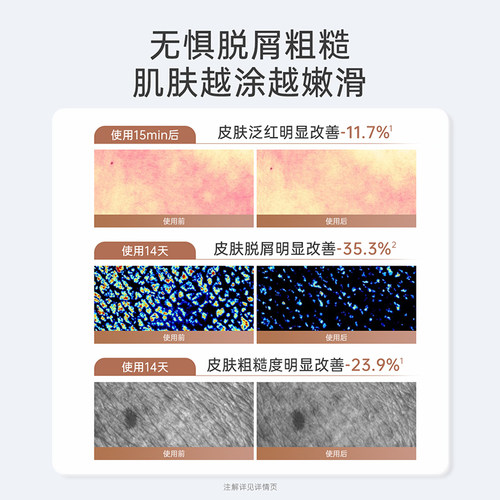 袋鼠妈妈备孕身体乳妇女润肤露保湿滋润润体乳四季干燥敏感肌可用 - 图1