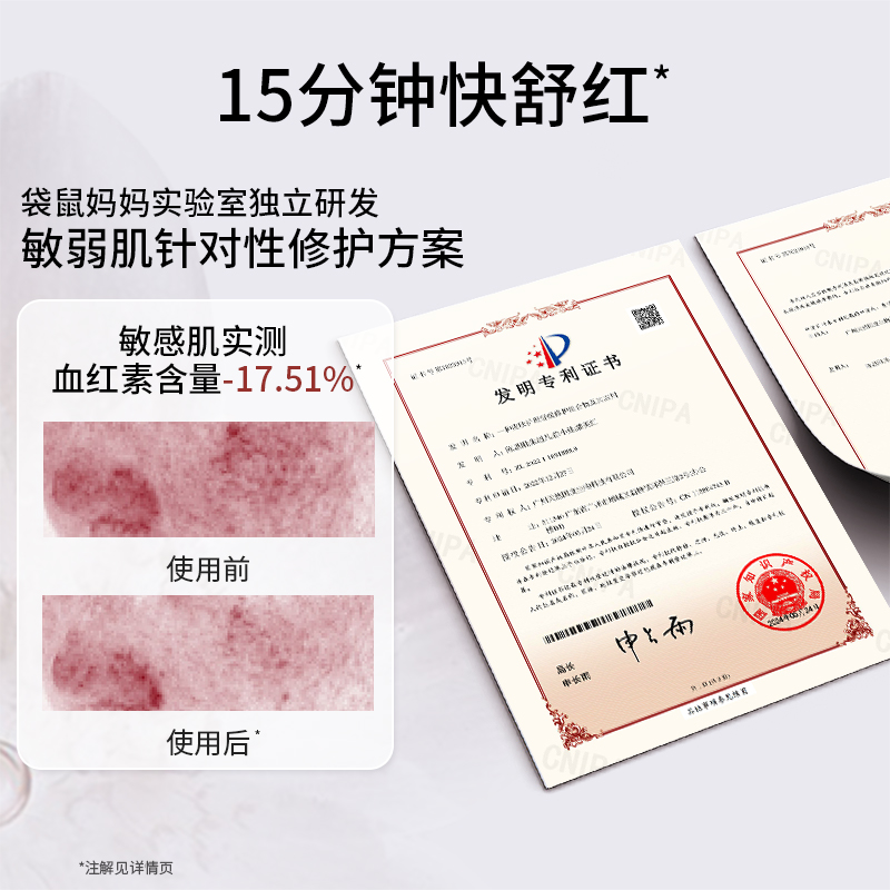 【预售付定】袋鼠妈妈高山火绒草水乳护肤套装修护补水准孕妇面霜