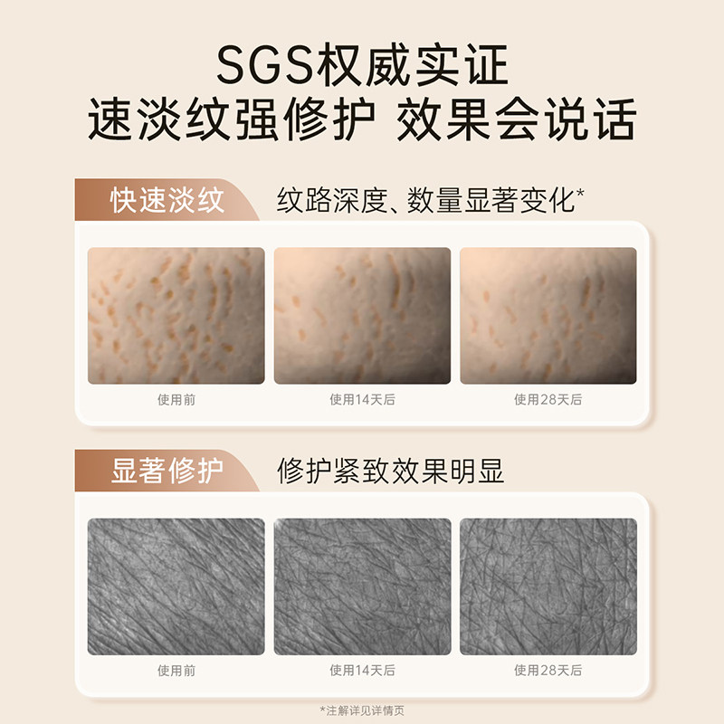 【直播间专享】袋鼠妈妈双萃抚纹精华乳准孕妇专用妊娠油2ml*5片