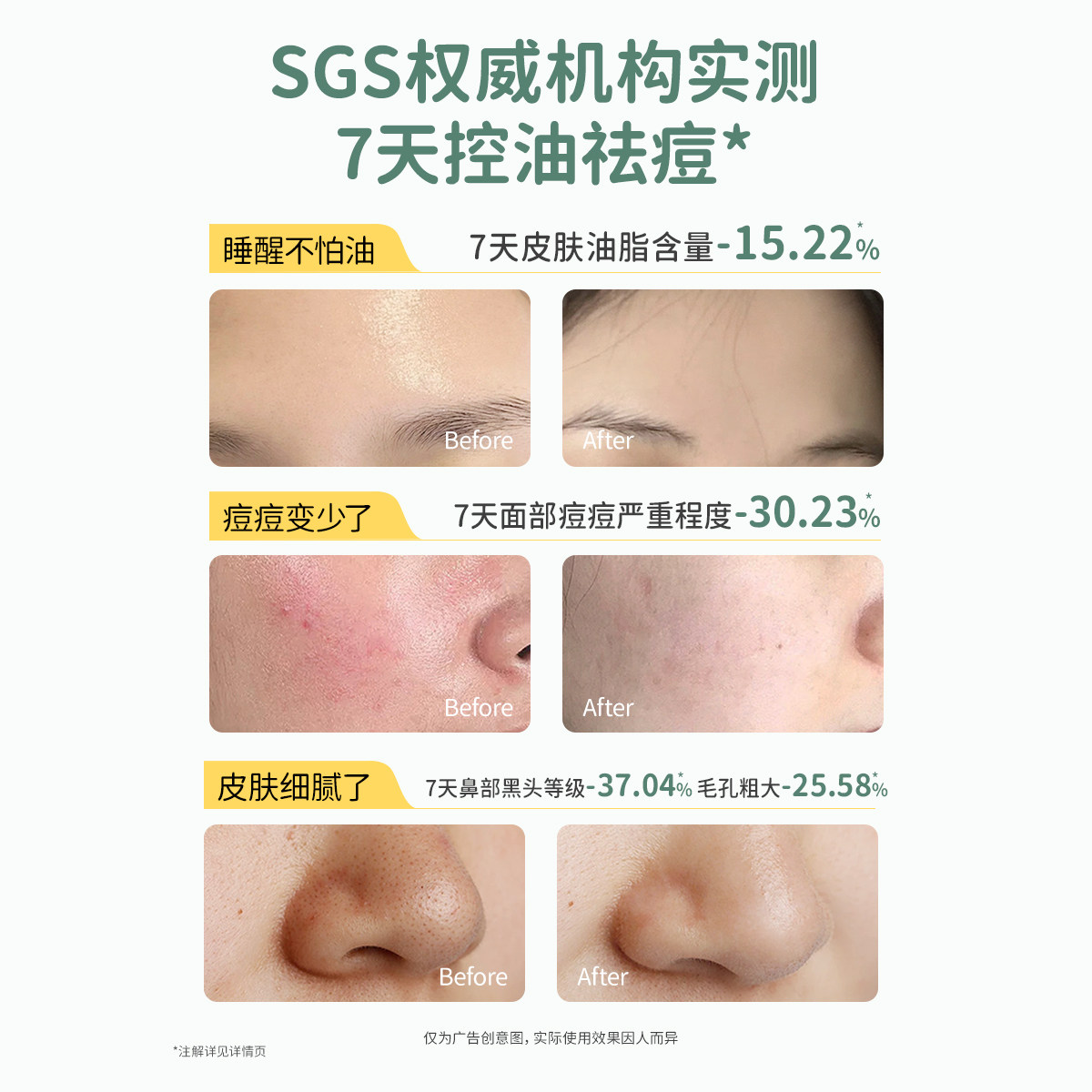 袋鼠妈妈青少年洁面乳男女孩青春专用控油祛痘黑头学生洗面奶官方