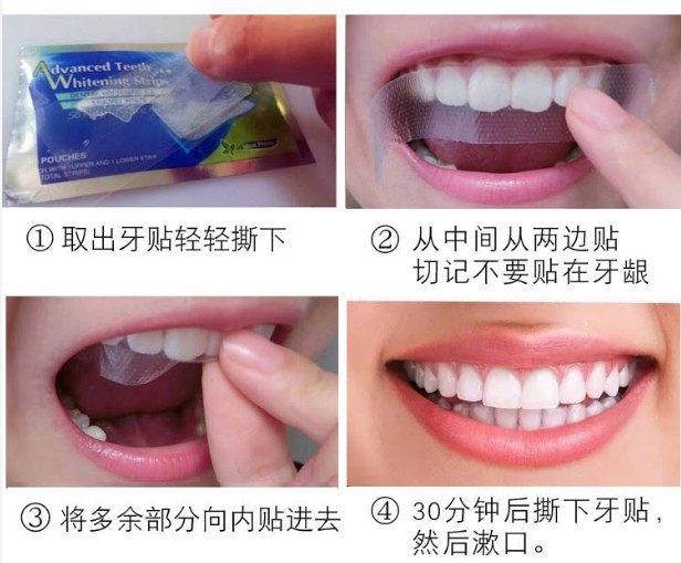 美白牙贴面快速去黄洁白李佳琦推荐 舒美口腔牙齿美白脱色剂
