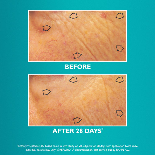 现货彼得罗夫PTR21胜肽抗皱紧致弹润眼霜15ml 提亮淡化黑眼圈浮肿 - 图0