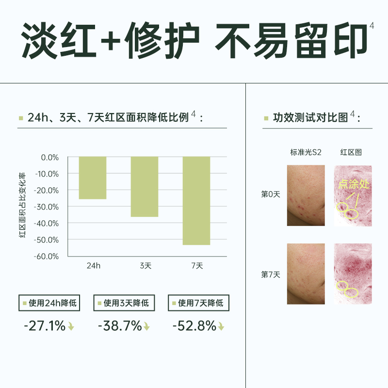 授权正品总代愤怒成分森月祛痘精华5ml代谢角质收敛清痘淡化痘印-图1