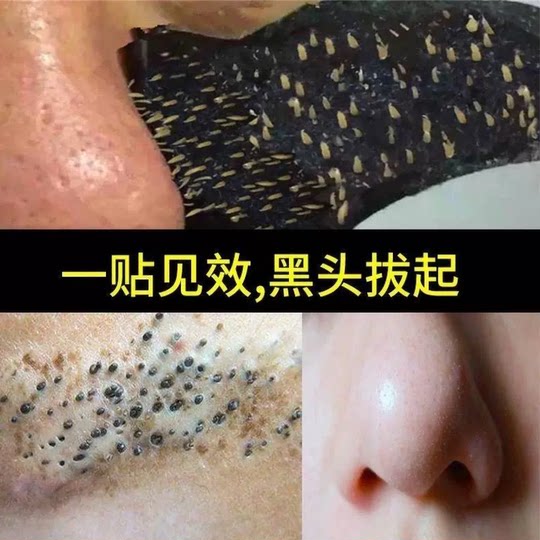 Blackhead remover peel-off deep cleansing pore shrinking firming acne remover nose patch strong blackhead suction nose patch